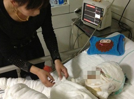 吉林一男子追求16歲女孩遭拒 火燒行兇